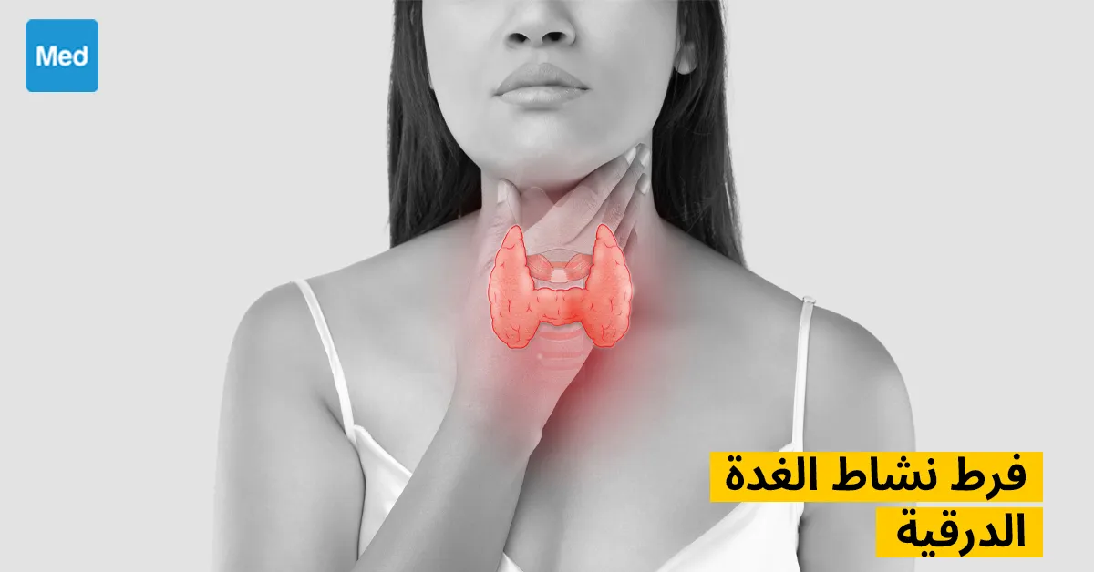 فرط نشاط الغدة الدرقية